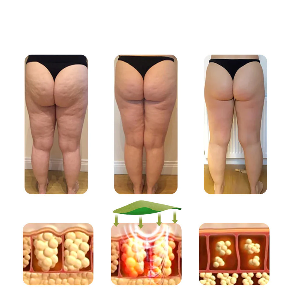 Miniatuur 4
