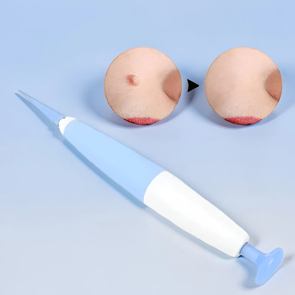 Miniatuur 3